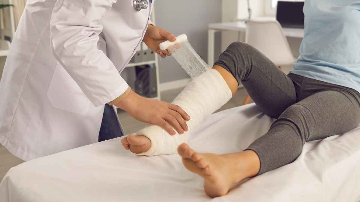 Médico coloca escayola en la pierna de trabajadora con fractura tras accidente para incapacidad permanente INSS